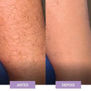 Depilação Suave - Crystal Hair Eraser™